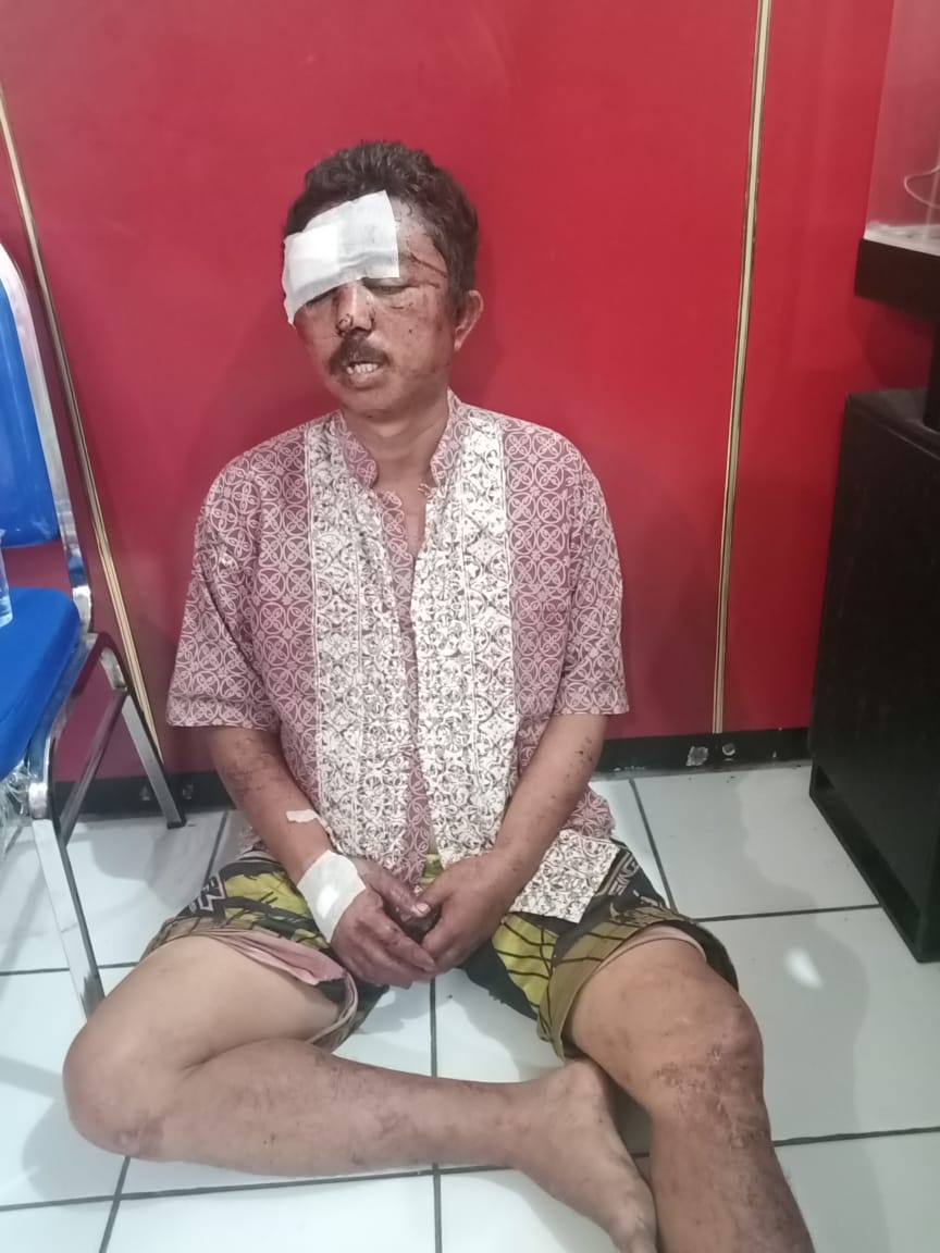 Pencuri Sepeda Motor di Kedinding, Babak Belur Di Keroyok Warga