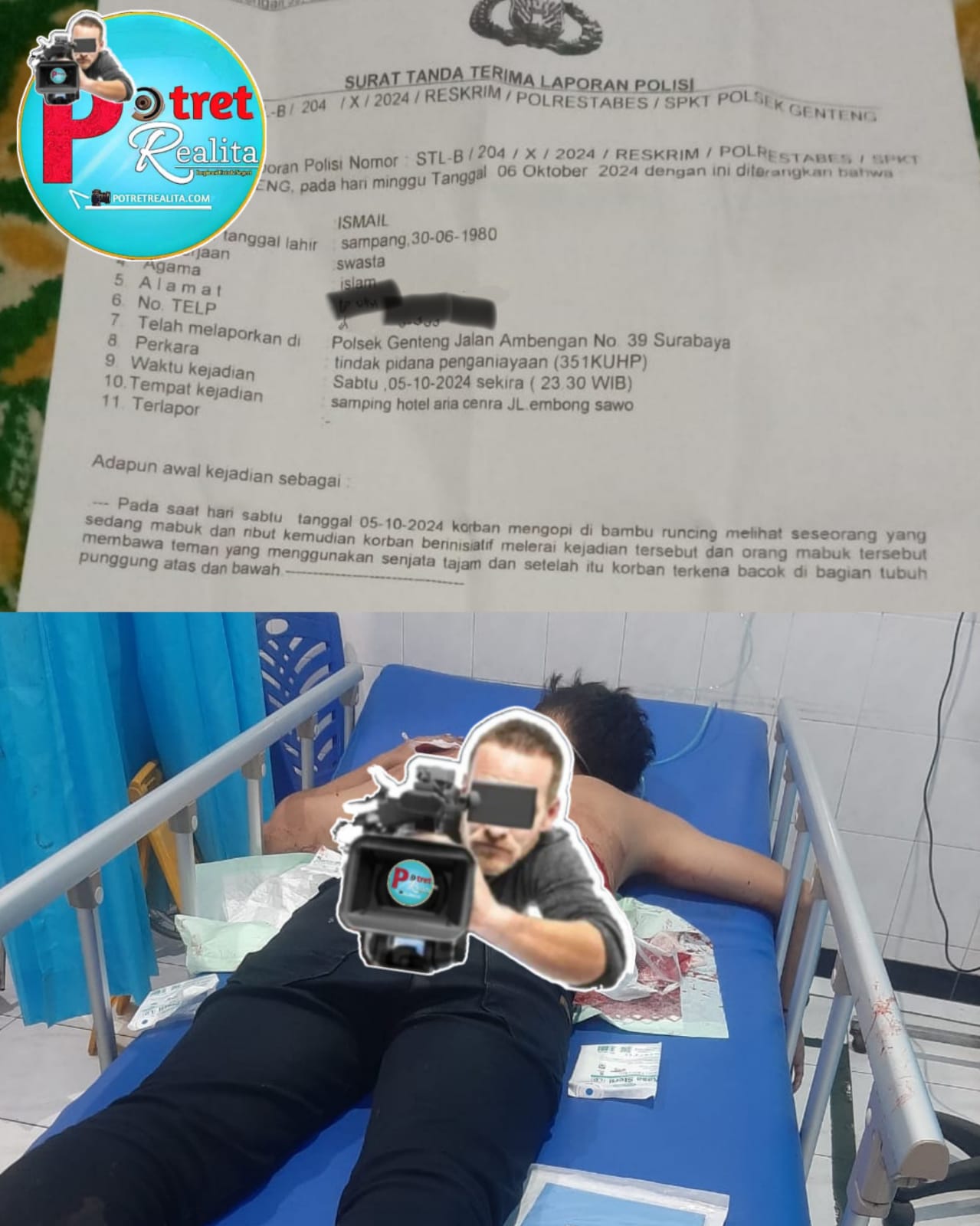 Aneh!!! Polsek Genteng Tidak Mampu Tangkap Pelaku Pembacokan